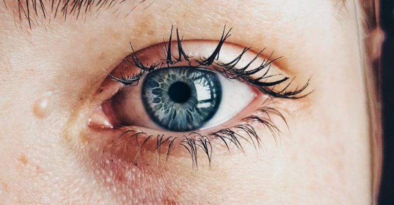 Oily Skin - Person Showing Left Eye